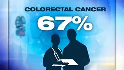 Colon Cancer
